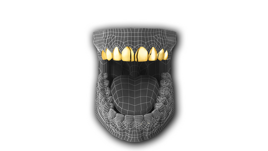 18 Karat vergoldet |   Eight